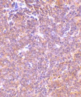 ab45426 at 10µg/ml staining PAK2 in mouse spleen tissue by IHC
