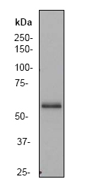 Anti-PAK3 antibody [EP797Y] (ab40808) at 1/50000 dilution + fetal brain lysate at 10 µg