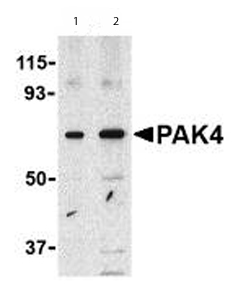 Lane 1 :  Anti-PAK4 antibody (ab62509) at 1 µg/mlLane 2 :  Anti-PAK4 antibody (ab62509) at 2 µg/mlLane 1 : SW480 cell lysateLane 2 : SW480 cell lysateLysates/proteins at 15 µg per lane.