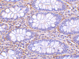 Immunohistochemistry of PAK4 in paraffin embedded human colon tissue section with ab62509 antibody at 10 µg/ml.