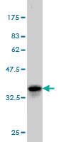 Western blot against tagged recombinant protein immunogen using ab56591 PAK4 antibody at 1ug/ml.
