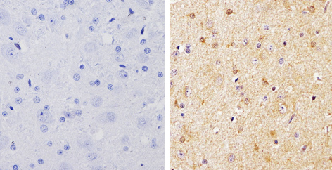 Immunohistochemistry (Formalin/PFA-fixed paraffin-embedded sections) analysis of pan Arrestin showing staining in the cytoplasm and nucleus of paraffin-treated rat brain tissue (right) compared with a negative control in the absence of primary antibody (left). Antigen retrieval was performed using 10mM sodium citrate (pH 6.0), microwaved for 8-15 min. Tissues were blocked in 3% H2O2-methanol for 15 min at room temperature, washed with ddH2O and PBS, and then incubated with ab2914 diluted by 3% BSA-PBS at a dilution of 1:500 overnight at 4°C in a humidified chamber. Tissues were washed extensively in PBST and detection was performed using an HRP-conjugated secondary antibody followed by colorimetric detection using a DAB kit. Tissues were counterstained with hematoxylin and dehydrated with ethanol and xylene to prep for mounting.