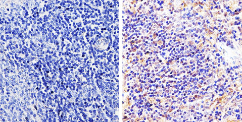 Immunohistochemistry (Formalin/PFA-fixed paraffin-embedded sections) analysis of pan Arrestin showing staining in the cytoplasm and nucleus of paraffin-treated rat spleen tissue (right) compared with a negative control in the absence of primary antibody (left). Antigen retrieval was performed using 10mM sodium citrate (pH 6.0), microwaved for 8-15 min. Tissues were blocked in 3% H2O2-methanol for 15 min at room temperature, washed with ddH2O and PBS, and then incubated with ab2914 diluted by 3% BSA-PBS at a dilution of 1:500 overnight at 4°C in a humidified chamber. Tissues were washed extensively in PBST and detection was performed using an HRP-conjugated secondary antibody followed by colorimetric detection using a DAB kit. Tissues were counterstained with hematoxylin and dehydrated with ethanol and xylene to prep for mounting.