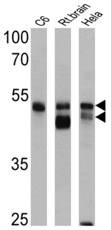 All lanes : Anti-pan Arrestin antibody (ab2914) at 1/1000 dilutionLane 1 : C6 cell lysateLane 2 : Rat brain cell lysateLane 3 : HeLa cell lysateLysates/proteins at 25 µg per lane.
