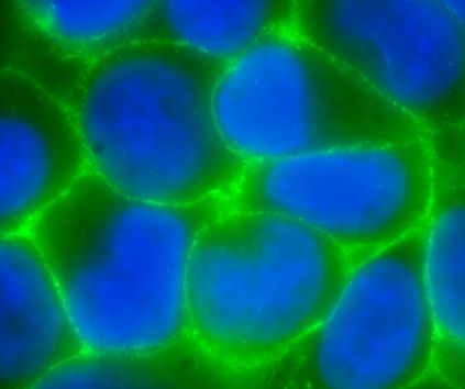 Immunofluorescent imaging of human cells (U2OS) with ab6528 reveals the expected highly specific membranous distribution. IF was performed with a standard paraformaldehyde technique (fixed in PBS buffered PFH 4% for 5 minutes, permeabilised with 0.5% triton-PBS for 5 minutes, blocked with 5% milk / 0.2% tween for one hour. Primary antibody used at 1/100 in 5% milk / 0.2% TWEEN for one hour, secondary antibody for 30 minutes.  All blocking and incubation steps carried out at 37 degrees C.