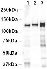 All lanes : Anti-pan Cadherin antibody - Plasma Membrane Marker (ab16505) at 1 µg/mlLane 1 : Human heart lysateLane 2 : Mouse heart lysateLane 3 : Rat heart lysateLysates/proteins at 20 µg per lane.SecondaryGoat Anti-Rabbit IgG H&L (HRP) preadsorbed (ab7090) at 1/5000 dilutiondeveloped using the ECL techniquePerformed under reducing conditions.