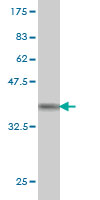 Western blot against tagged recombinant protein immunogen using ab57466 Neuroligin 4 antibody at 1ug/ml.