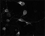 ab69091 at 1/2000 dilution staining Pan Rho + RAC (1,2,3) + CDC42 in 1 day- old mouse cortical cell culture by Immunofluorescence. DAPI counter stained.