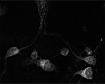 ab69091 at 1/2000 dilution staining Pan Rho + RAC (1,2,3) + CDC42 in 1 day- old mouse cortical cell culture by Immunofluorescence. DAPI counter stained.