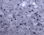 ab69091 at 1/1000 dilution staining Pan Rho + RAC (1,2,3) + CDC42 in rat midbrain by Immunohistochemistry. Pre-absorption of the antibody with the immunising peptide completely abolishes the immunostaining (not shown).