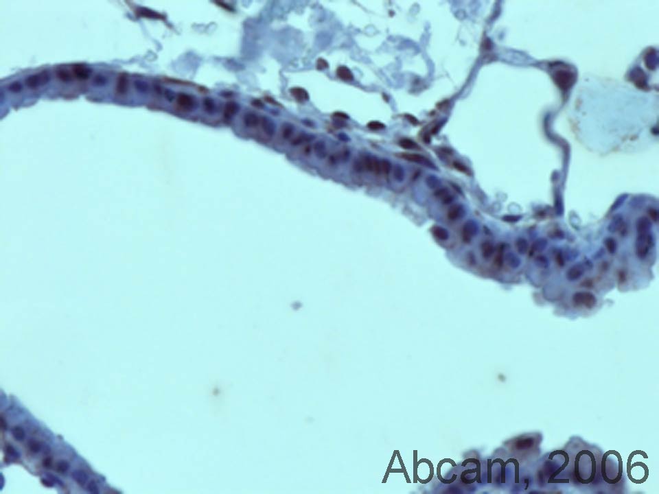 Anti-NLK was used in standard Vector ABC protocol on paraffin embedded mouse lung with the following modifications: HIER with Vector antigen unmasking solution for 25 minutes at 98C. Used a 1:100 dilution in PBS/Triton-X 4C overnight.
