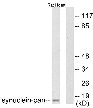 All lanes : Anti-pan Synuclein antibody (ab53726) at 1/500 dilutionLane 1 : rat heart lysateLane 2 : rat heart lysate with immunizing peptideLysates/proteins at 5 µg per lane.SecondaryAlkaline Phosphatase Goat Anti-Rabbit IgG (H+L)
