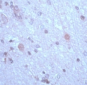 Human brain stained with ab15534