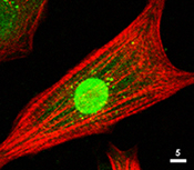 The Akt antibody (ab8805) is used at 1/80 on cultured neonatal rat cardiomyocytes that express a nuclear-targeted Akt construct. The green is Akt antibody, the red is Texas-red™ phalloidin that labels actin filaments.