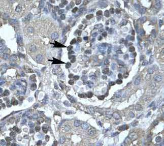 ab49288 at 8ug/ml staining epithelial cells of renal corpuscle (arrows) in human kidney tissue.