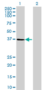 All lanes : Anti-PANK1 antibody (ab69354) at 1/500 dilutionLane 1 : PANK1 transfected 293T cell lysateLane 2 : Non-transfected 293T cell lysateLysates/proteins at 25 µg per lane.SecondaryGoat Anti-Mouse IgG (H&L)-HRP Conjugate at 1/2500 dilution