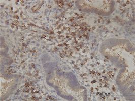 PANK2 antibody (ab57766) used in immunohistochemistry at 5ug/ml on formalin fixed and paraffin embedded human endometrium tissue.