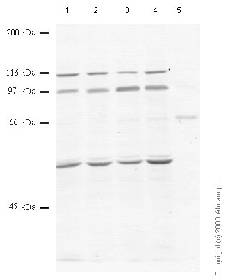 All lanes : Anti-PAPP A2 antibody (ab59094) at 1/1000 dilutionLane 1 : Whole cell lyste prepared from human breast cancer MDA-MB-231 cells (treated with SF)Lane 2 : Whole cell lyste prepared from human breast cancer MDA-MB-231 cells (treated with TPA)Lane 3 : Whole cell lyste prepared from human breast cancer MDA-MB-231 cells (treated with IL1-beta)Lane 4 : Whole cell lyste prepared from human breast cancer MDA-MB-231 cells (treated with TNF-alpha)Lane 5 : Whole cell lyste prepared from human breast cancer MDA-MB-231 cells (treated with Testosterone)Lysates/proteins at 20 µl per lane.