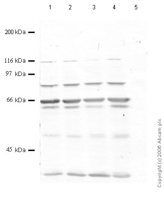 All lanes : Anti-PAPP A2 antibody (ab59097) at 1/1000 dilutionLane 1 : Whole cell lyste prepared from human breast cancer MDA-MB-231 cells (treated with SF)Lane 2 : Whole cell lyste prepared from human breast cancer MDA-MB-231 cells (treated with TPA)Lane 3 : Whole cell lyste prepared from human breast cancer MDA-MB-231 cells (treated with IL1-beta)Lane 4 : Whole cell lyste prepared from human breast cancer MDA-MB-231 cells (treated with TNF-alpha)Lane 5 : Whole cell lyste prepared from human breast cancer MDA-MB-231 cells (treated with Testosterone)Lysates/proteins at 20 µl per lane.