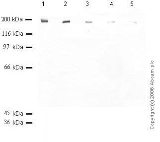 All lanes : Anti-PAPP A2 antibody (ab59099) at 1/1000 dilutionLane 1 : Recombinant Human Pappalysin-2 at 0.08 µgLane 2 : Recombinant Human Pappalysin-2 at 0.04 µgLane 3 : Recombinant Human Pappalysin-2 at 0.02 µgLane 4 : Recombinant Human Pappalysin-2 at 0.01 µgLane 5 : Recombinant Human Pappalysin-2 at 0.005 µg