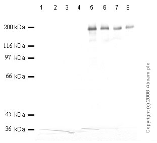 All lanes : Anti-PAPP A2 antibody (ab59100) at 1/1000 dilutionLane 1 : Recombinant Human Pappalysin-1 at 0.04 µgLane 2 : Recombinant Human Pappalysin-1 at 0.02 µgLane 3 : Recombinant Human Pappalysin-1 at 0.01 µgLane 4 : Recombinant Human Pappalysin-1 at 0.005 µgLane 5 : Recombinant Human Pappalysin-2 at 0.04 µgLane 6 : Recombinant Human Pappalysin-2 at 0.02 µgLane 7 : Recombinant Human Pappalysin-2 at 0.01 µgLane 8 : Recombinant Human Pappalysin-2 at 0.005 µg