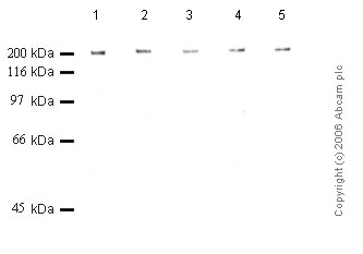 All lanes : Anti-PAPP A2 antibody (ab59101) at 1/1000 dilutionLane 1 : Recombinant Human Pappalysin-2 at 0.12 µgLane 2 : Recombinant Human Pappalysin-2 at 0.1 µgLane 3 : Recombinant Human Pappalysin-2 at 0.08 µgLane 4 : Recombinant Human Pappalysin-2 at 0.06 µgLane 5 : Recombinant Human Pappalysin-2 at 0.04 µg