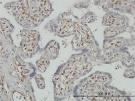PAPSS2 antibody (ab56393) used in immunohistochemistry at 3ug/ml on formalin fixed and paraffin embedded human placenta.