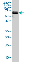 PAPSS2 antibody (ab56393) at 1ug/lane + A-431 cell lysate at 25ug/lane.
