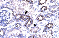 Immunohistochemistry (Formalin/PFA-fixed paraffin-embedded sections) analysis of human kidney tissue labelling PAR4 with ab49155 at 4-8µg/ml. Arrows indicate positively labelled eithelial cells of renal tubule. Magnification: 400X.