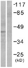 All lanes : Anti-PAR4 antibody (ab53718) at 1/500 dilutionLane 1 : Extracts from NIH/3T3 cells, minus immunising peptideLane 2 : Extracts from NIH/3T3 cells, plus immunising peptide
