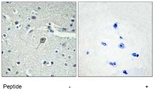 Immunohistochemistry analysis of Parathyroid Hormone Receptor 1 in paraffin-embedded human brain tissue using ab75150, at 1/50 dilution, in the presence (right panel) or absence (left panel) of immunising peptide.