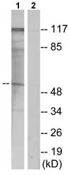 All lanes : Anti-Parathyroid Hormone Receptor 1 antibody (ab75150) at 1/500 dilutionLane 1 : Extracts from Jurkat cellsLane 2 : Extracts from Jurkat cells with immunising peptide at 5 µgLysates/proteins at 5 µg per lane.