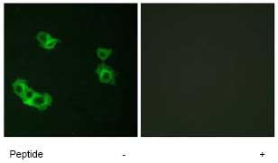 Immunofluorescence analysis of Parathyroid Hormone Receptor 1 in MCF7 cells using ab75150, at 1/500 dilution, in the presence (right panel) or absence (left panel) of immunising peptide.