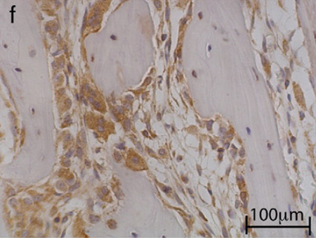 Immunohistochemical analysis of rabbit bone treated with Parathyroid Hormone, staining Parathyroid Hormone Receptor 1 with ab3271. Antigen retrieval was performed by heat mediation in a citrate buffer and tissue was then blocked with protein block solution for 20 minutes. Sections were incubated with primary antibody (1/50) overnight in a humid chamber before incubating with a biotinylated secondary antibody. Staining was detected using DAB.