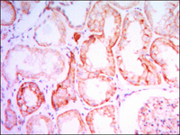 ab104832 at 1/200 dilution staining Parathyroid Hormone Receptor 1 in Human kidney by Immunohistochemistry, Paraffin-embedded tissue with DAB staining.
