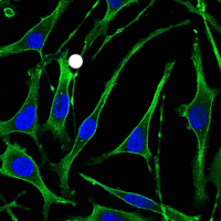 ab104832 staining Parathyroid Hormone Receptor 1 in SK-BR-3 cells by Immunofluorescence (green). Blue: DRAQ5 fluorescent DNA dye.