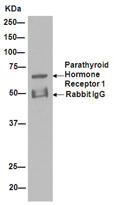 Western blot analysis of Parathyroid Hormone Receptor 1 in HeLa lysate immunoprecipitated using ab189924 at 1/50 dilution.Secondary: Goat Anti-Rabbit IgG, (H+L), Peroxidase conjugate at 1/1000 dilution.