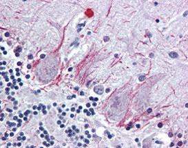 ab115688 at 10ug/ml staining Parathyroid Hormone Receptor 2 in Formalin-fixed, Paraffin-embedded Human brain (cerebellum) tissue by Immunohistochemistry.