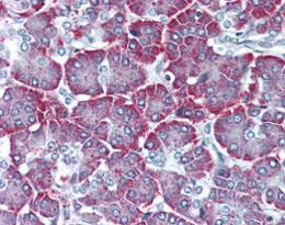 ab115688 at 10ug/ml staining Parathyroid Hormone Receptor 2 in Formalin-fixed, Paraffin-embedded Human Pancreas tissue by Immunohistochemistry.