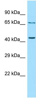 Anti-Parathyroid Hormone Receptor 2 antibody (ab133924) at 1 µg/ml + OVCAR3 cell lysate at 10 µg