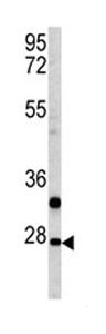 Anti-Parathyroid hormone related protein antibody (ab85205) at 1/50 dilution + mouse spleen tissue lysate at 35 µg