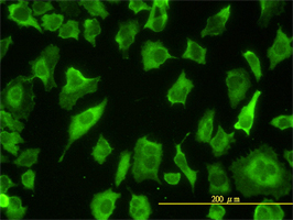 PARD6B antibody (ab57838) used in immunofluorescence at 10ug/ml on HeLa cells.