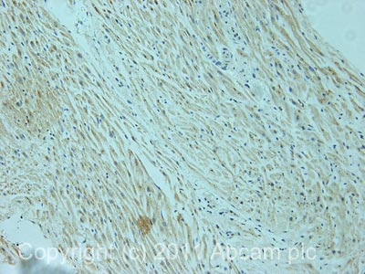 IHC image of ab67577 staining in human heart formalin fixed paraffin embedded tissue section, performed on a Leica BondTM system using the standard protocol F. The section was pre-treated using heat mediated antigen retrieval with sodium citrate buffer (pH6, epitope retrieval solution 1) for 20 mins. The section was then incubated with ab67577, 5µg/ml, for 15 mins at room temperature and detected using an HRP conjugated compact polymer system. DAB was used as the chromogen. The section was then counterstained with haematoxylin and mounted with DPX.For other IHC staining systems (automated and non-automated) customers should optimize variable parameters such as antigen retrieval conditions, primary antibody concentration and antibody incubation times.