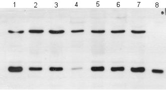Western blot using clone malphaDJ-1/E2.19 and a beta actin antibody as a loading control.The bottom band is PARK7/DJ1, the top band is beta actin.Lane 1: 293 cell lysateLane 2: MCF-7 cell lysateLanes 3-7: various different prostate cell linesLane 8: recombinant PARK7/DJ1 (that was used as immunogen for this antibody)