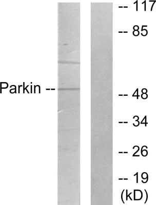 All lanes : Anti-Parkin antibody (ab53042) at 1/500 dilutionLane 1 : Jurkat cell extractLane 2 : Jurkat cell extract with immunising peptide