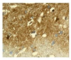 Immunohistochemical analysis of paraffin-embedded Human brain tissue labeling Parkin with ab179812 at 1/50 dilution.