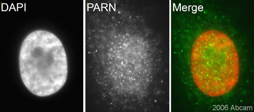 ab27778, at 1/100 dilution, staining human PARN in HeLa cells.See Abreview