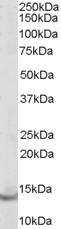 Anti-Parvalbumin antibody (ab32895) at 0.1 µg/ml + Human Brain lysate at 35 µg