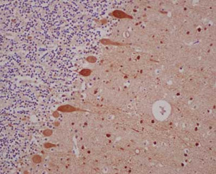 Immunohistochemical analysis of paraffin-embedded Human cerebellum tissue labeling Parvalbumin with ab181086 at a 1/500 dilution.