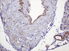 Immunohistochemical analysis of paraffin embedded Human pancreas tissue labelling PARVB with ab140384 at 1/150 dilution.
